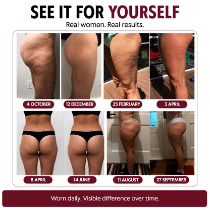 3D Anti-Cellulite Leggings