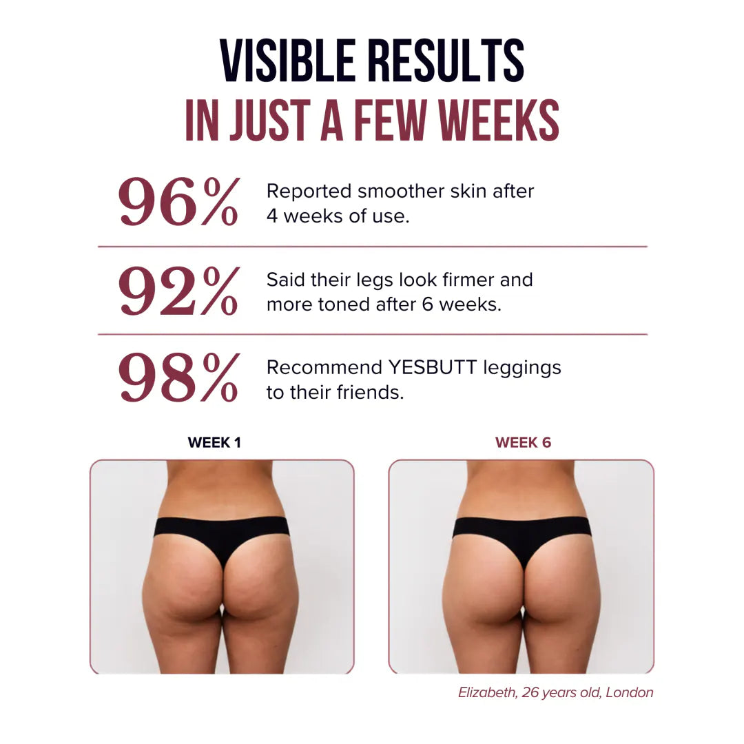 3D Anti-Cellulite Leggings