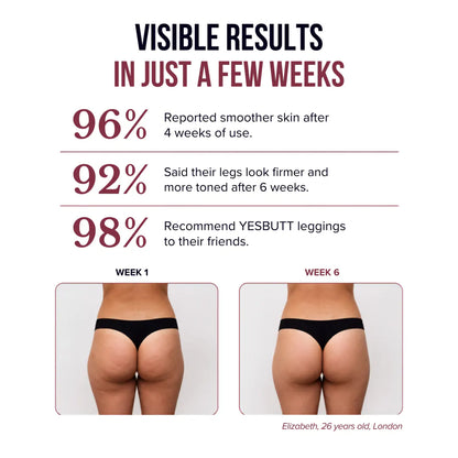 3D Anti-Cellulite Leggings